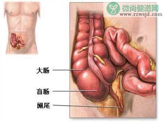 急性阑尾炎腹痛有哪些特点 阑尾炎除了痛还有什么表