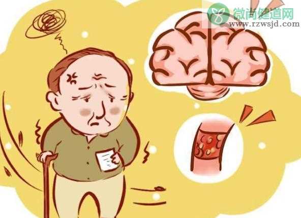 阿尔茨海默症早期会怎么样 记忆力减退注意力不集中