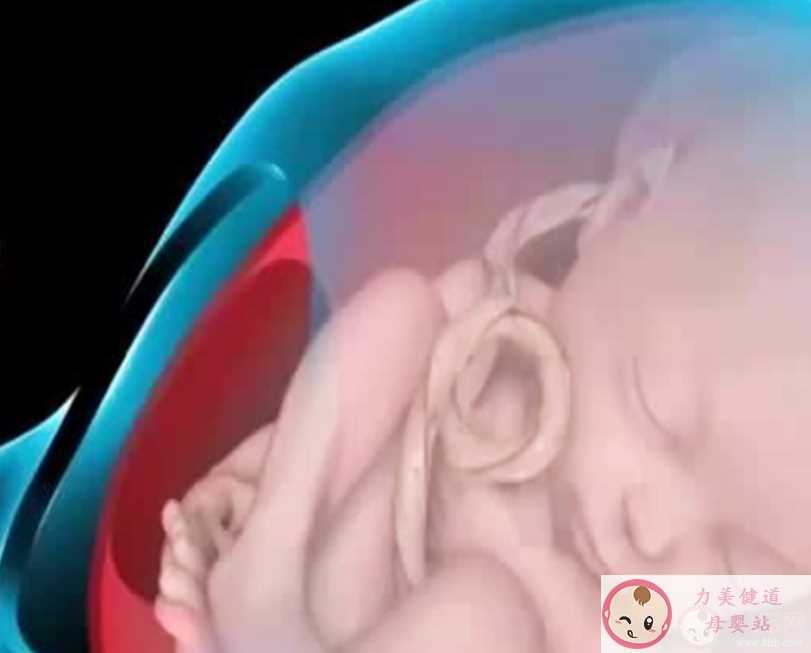 胎儿脐带绕颈能顺产吗 胎儿脐带绕颈是什么原因