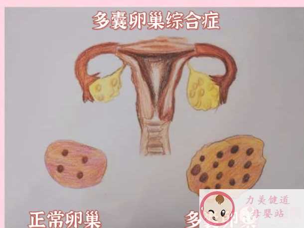 有多囊卵巢综合征女性会出现爆痘 多囊卵巢综合征会有哪些症状