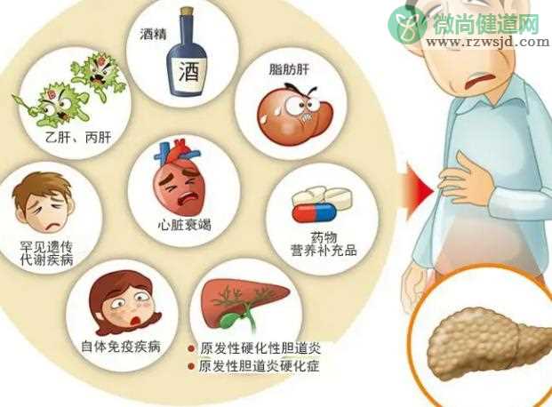 丙肝检查要空腹吗 丙肝治疗费用贵不贵