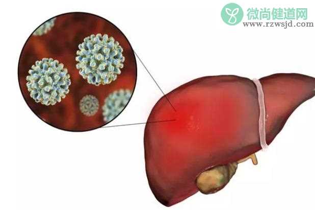 治疗丙肝用哪些药物有效 胸