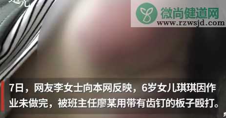 女童因未完成作业被老师打住