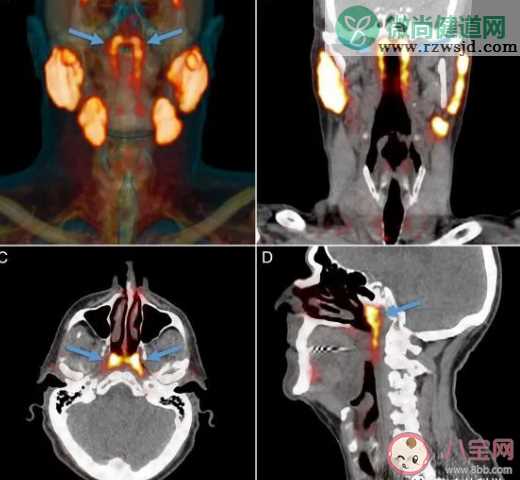 科学家发现人体未知新器官是真的吗 人体器官存在于