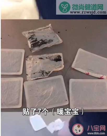 广州小伙贴7个暖宝宝后背冒烟是怎么引起的 暖宝宝会引起皮肤烫伤吗