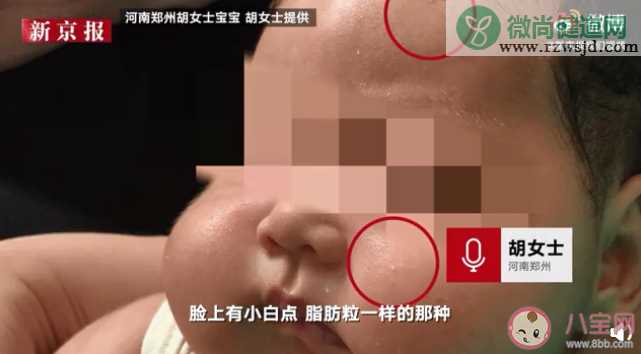 江西哪款婴儿抑菌霜被曝激素