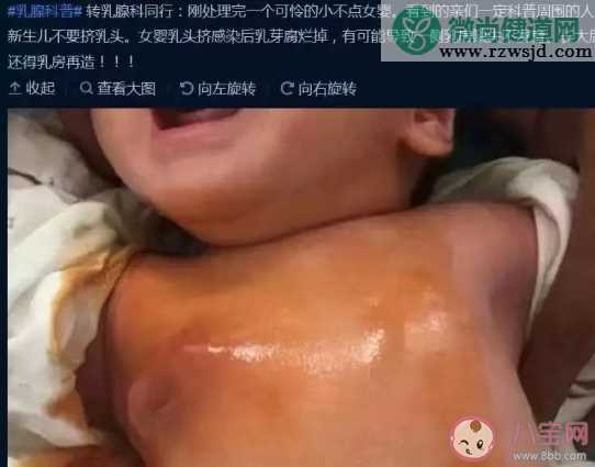 宝宝刚生出来就挤乳头好吗  新生女宝要不要挤乳头