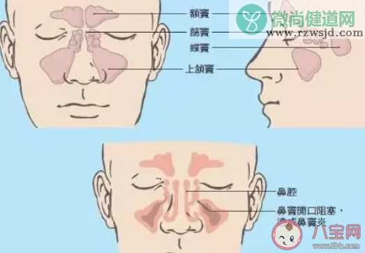 孩子鼻窦炎急性和慢性的区别 鼻窦炎用什么药好