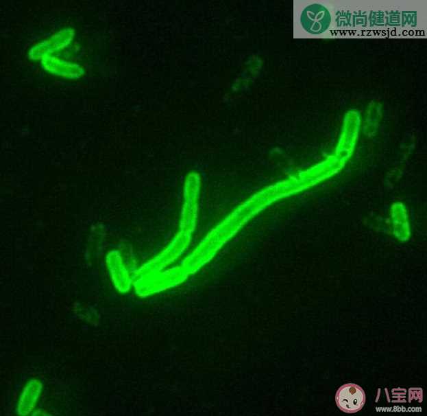 得了鼠疫有哪些症状 怎么做好鼠疫个人防护