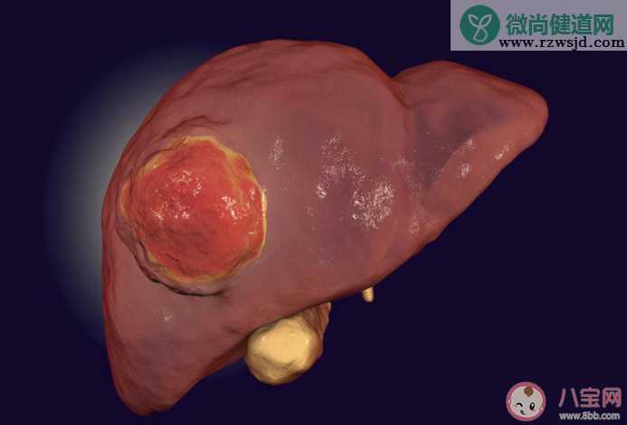 为什么肝癌一发现就是晚期 如何保护好肝脏