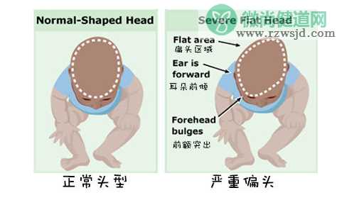 宝宝头型睡偏了怎么办 头型睡偏调整方法