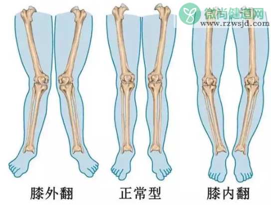 怎么让孩子腿又直又好看 培养孩子好看腿型的方法