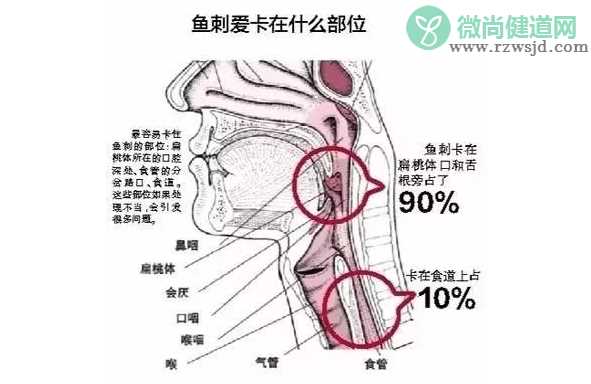 孩子鱼刺卡喉怎么办 鱼刺卡喉的正确做法