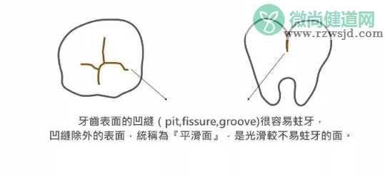 怎么判断孩子是不是蛀牙 孩子长蛀牙怎么保护孩子的牙齿