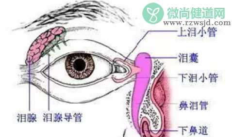 宝宝先天性泪囊炎需要泪道冲