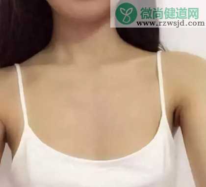 女性乳晕变黑是正常的吗 女性乳晕变黑是怎么回事