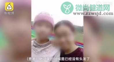 小学生开始脱发是真的吗 小学生脱发是怎么回事