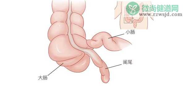 什么是小儿急腹症 儿童急腹症病因