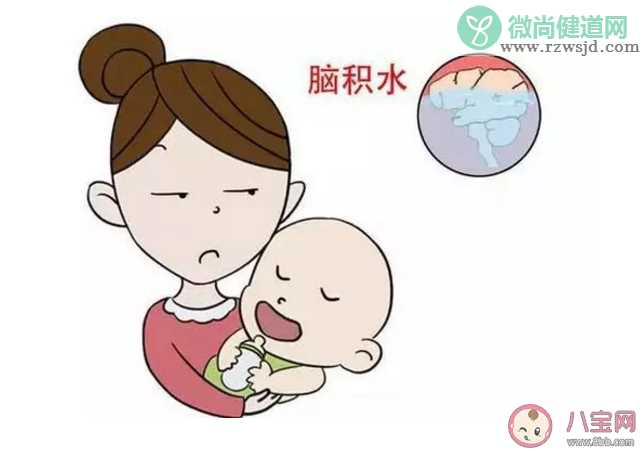 孩子的囟门闭合得晚是不是智力不太好 孩子的囟门闭