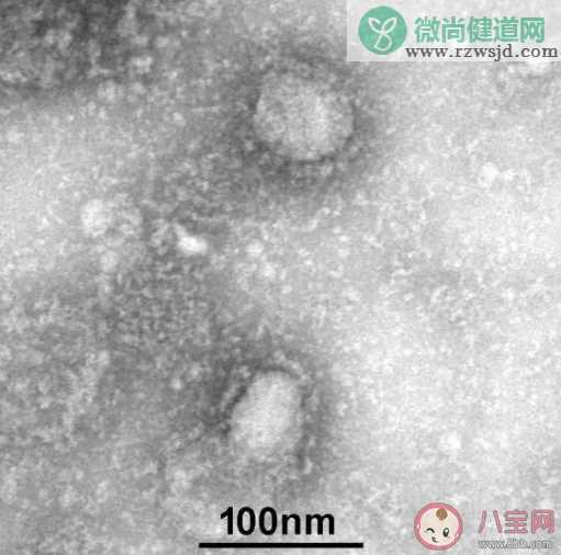 新型冠状病毒肺炎全国统一最