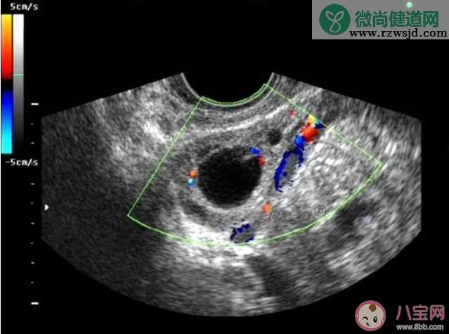 女性卵泡多大能受孕 怎么知道自己卵泡质量好不好