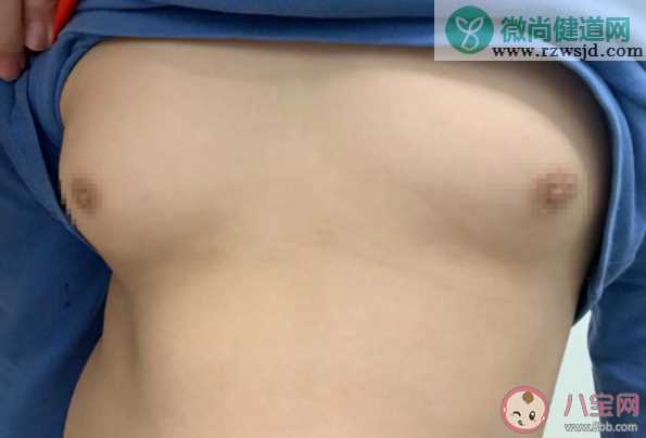 11岁男孩乳房发育直径超4厘米是怎么回事 男性乳房发育正常吗