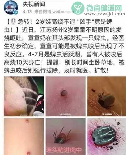 宝宝被蜱虫咬了怎么办 宝宝被蜱虫咬伤正确处理方法