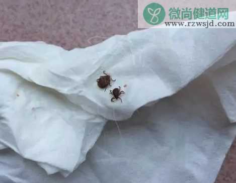 宝宝被蜱虫咬了怎么办 宝宝被蜱虫咬伤正确处理方法