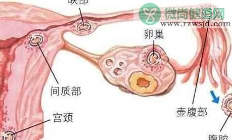 受精卵着床有什么症状  受精卵着床的表现一览