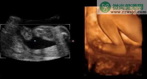 2019年1月27号行房受孕生男生女 农历腊月二十二怀孕生男孩还是女孩