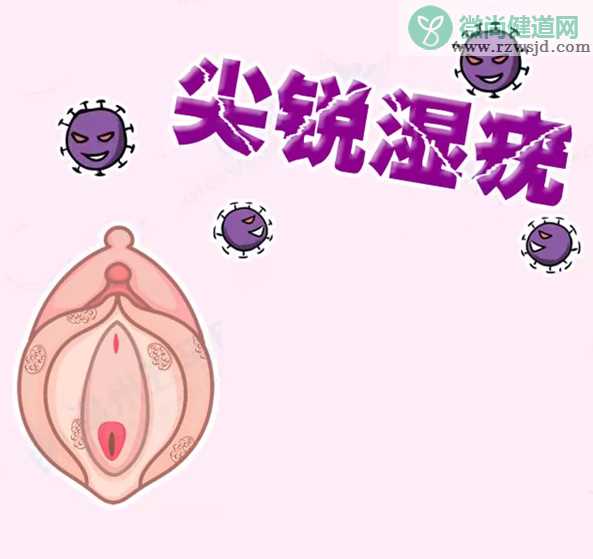 女性尖锐湿疣反复发作是什么