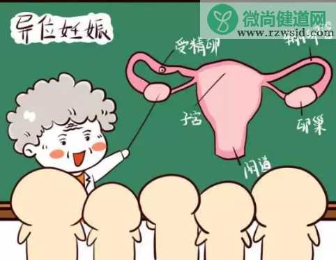 宫外孕手术后可以直接备孕吗