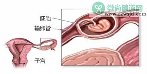 输卵管通而不畅可以喝中药吗