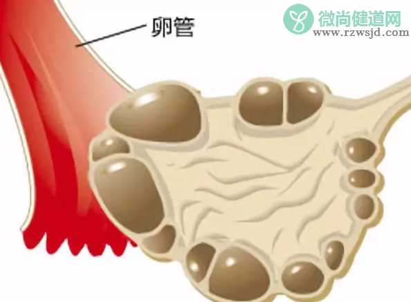 多囊患者可以自然排卵吗 多