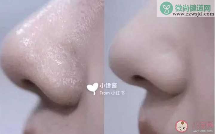 网上说的卡粉是什么意思 女生化爱卡粉是什么原因