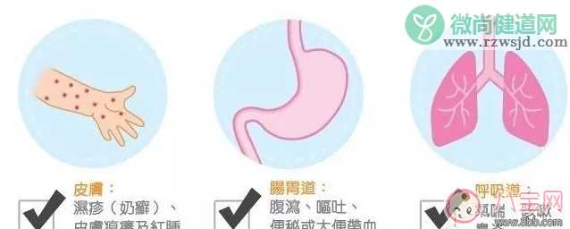 孩子哪些情况表明已经过敏了