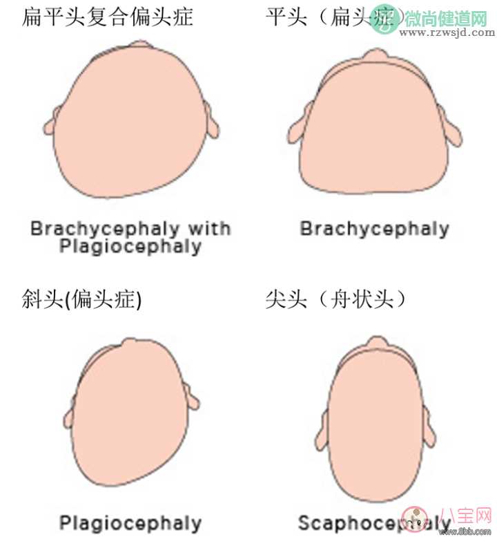 预防宝宝平头扁头 婴儿如何