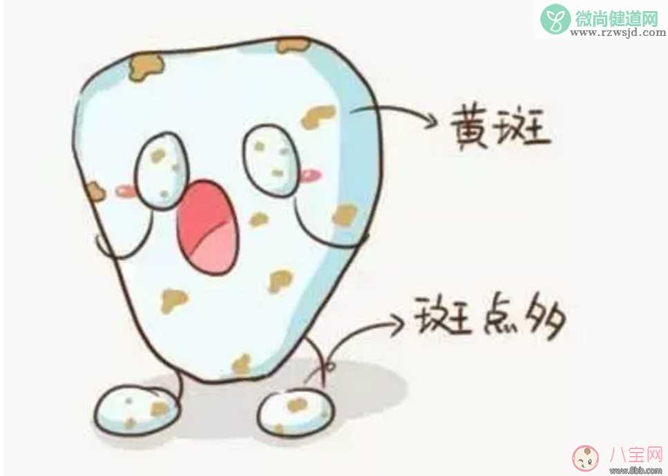 宝宝没有龋齿 却有黑牙是怎么回事？