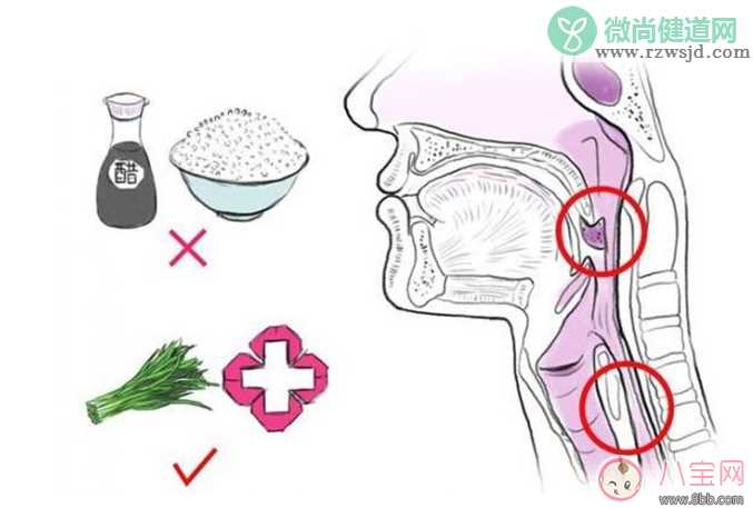 宝宝吃鱼卡鱼刺 急着自己去夹刺就大错特错了