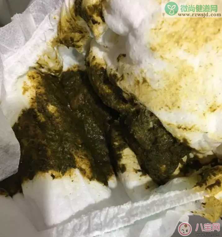 宝宝辅食颗粒大小如何把握  宝宝辅食添加原则有哪些？