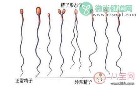 精子畸形率高能怀孕吗 精子