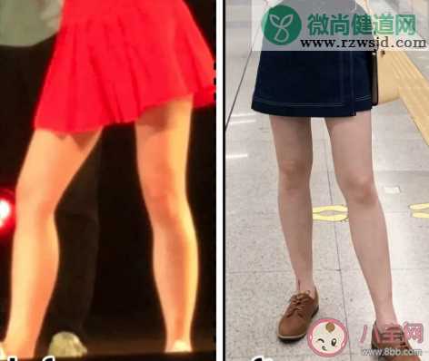 溶脂瘦腿针打完之后会反弹吗 瘦腿针会有什么后遗症