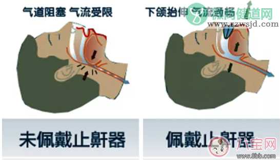 孩子吃饭总是咬到舌头怎么办 吃饭咬到舌头有哪些危害