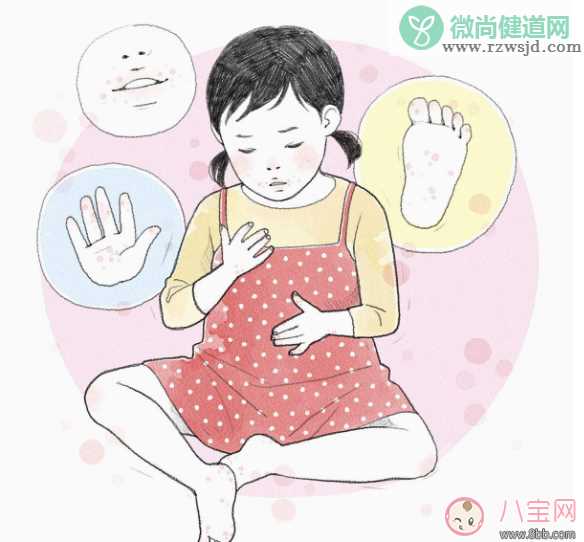 孩子手足口病是什么病 怎么预防手足口病