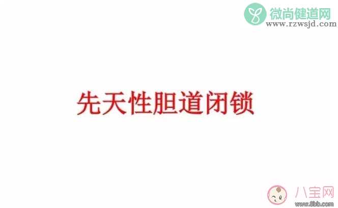 先天性胆道闭锁治疗可以治疗