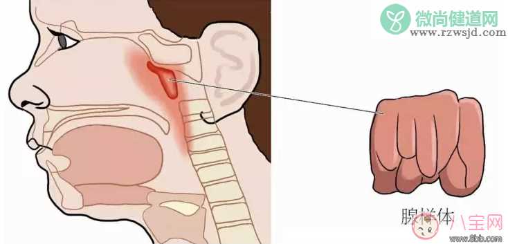 孩子喜欢打鼾是不是因为扁桃体发炎 孩子扁桃体发炎