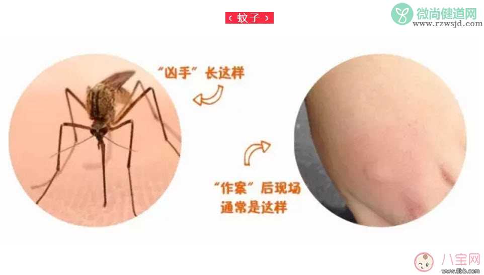 宝宝被跳蚤咬了症状图片 宝宝被跳蚤咬和蚊子咬症状对比图片区别