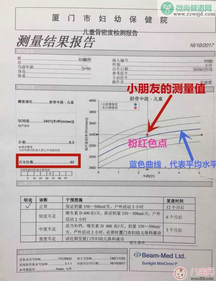 宝宝骨密度报告单怎么看 怎