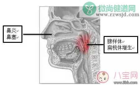 孩子睡觉的时候张口呼吸是什么原因 为什么会出现孩子张口呼吸的情况