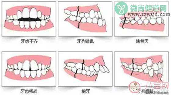 孩子吃饭总是咬到舌头怎么办 吃饭咬到舌头有哪些危害